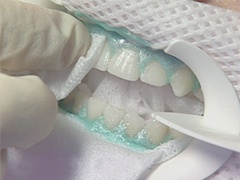 zoom tehnika beljenja zob